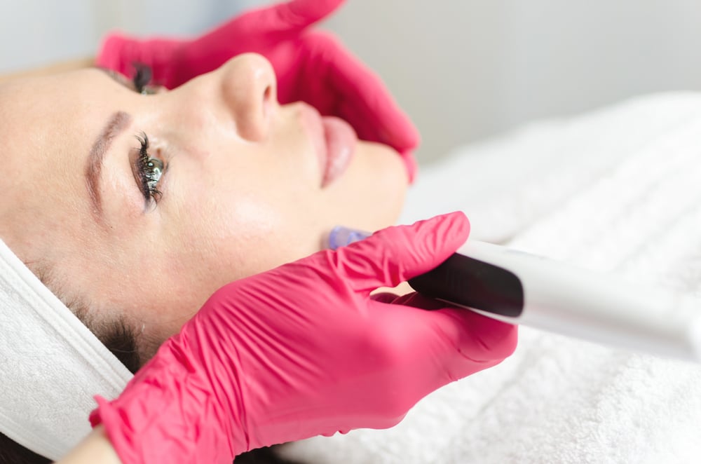 Everything You Need To Know About Microneedling at Ivonne Sanchez Beauty