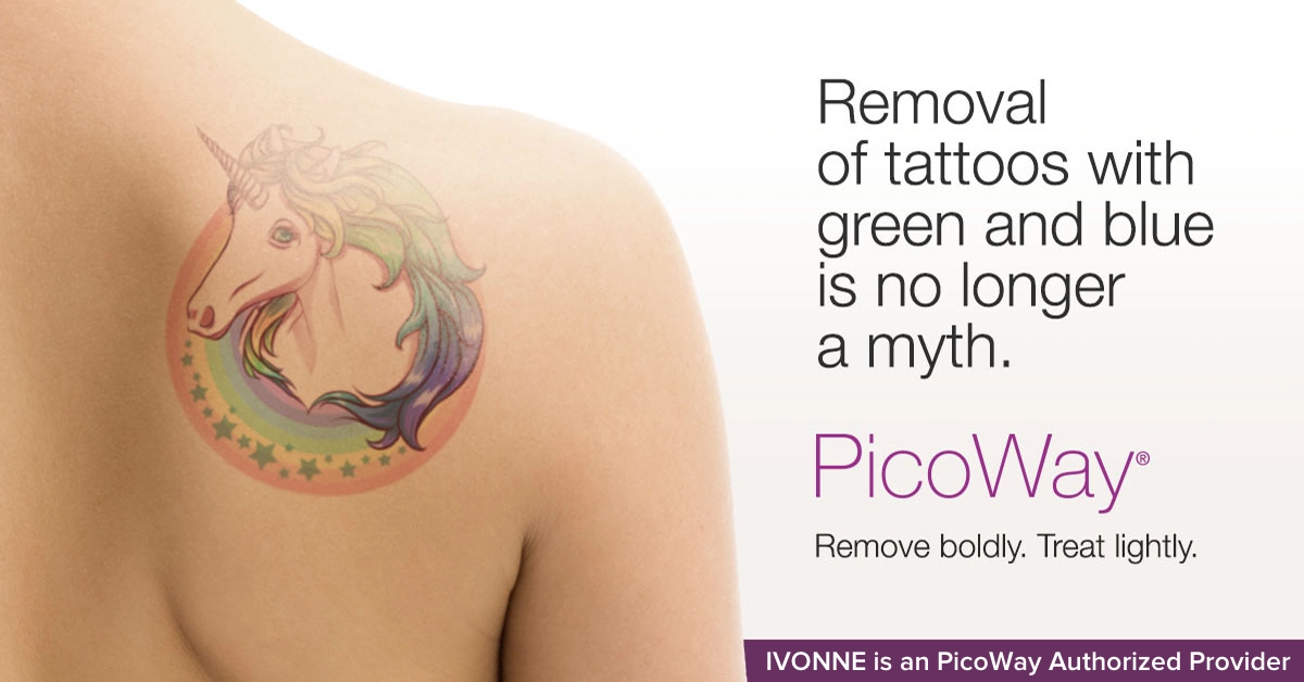 Picoway_Laser_Tattoo_Removal_Ottawa